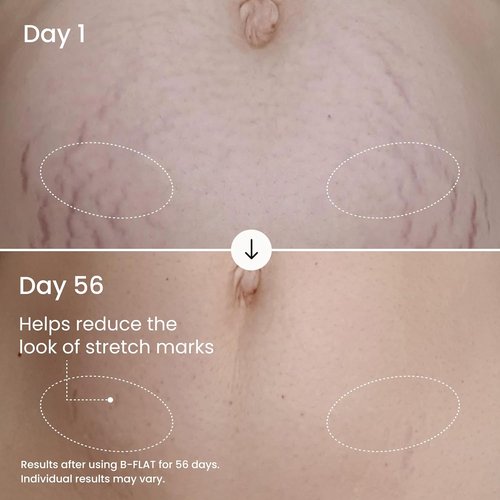 MAËLYS B-FLAT Belly Firming Cream - Skin Tightening & Moisturizing Treatment with Shea Butter | 3.4 Fl Oz
