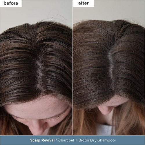 Briogeo Scalp Revival Scalp Care Essentials Set - Detox & Hydrate with Charcoal & Tea Tree | Vegan & Cruelty-Free