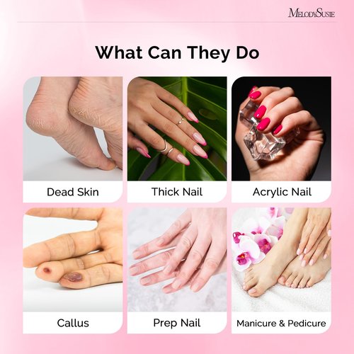 MelodySusie 300 Pcs Sanding Bands with Mandrel,120 Medium, 180 Fine, 240 Extreme Fine Grit, E-File Sand Piece Nail Drill Bits Set for Acrylic, Gel Removal, Manicures and Pedicures