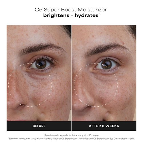 Paula's Choice C5 Super Boost Face Moisturizer - 5% Vitamin C & Squalane for Even Skin Tone