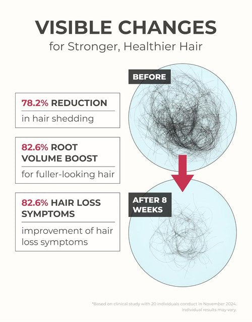 Motifull Hair Boosting Ampoule Tonic - Hair Growth Treatment for Thinning Hair | Lightweight Scalp Serum (1.69 fl. oz.)