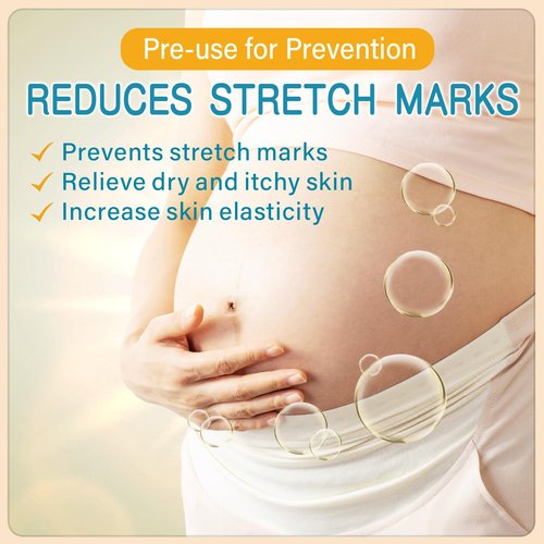 PEGO Stretch Mark Butter - Maternity Cream for Pregnancy & Postpartum Care | Hypoallergenic 100g/3.53oz