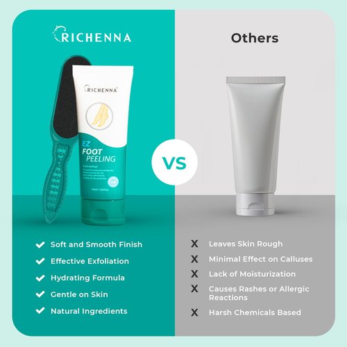 RICHENNA EZ Foot Care Cream - Advanced Exfoliating Urea Foot Cream for Dry Cracked Heels and Feet | 14 Natural Ingredients | Repairs, Hydrates and Smoothens Dry Cracked Feet - 100ml /3.38 fl. oz