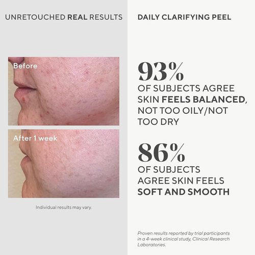 Murad Daily Clarifying Peel - Exfoliating AHA/BHA Liquid with Retinoid & Salicylic Acid for Smooth, Hydrated Skin - 3.2 Fl Oz