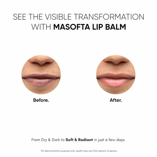 Masofta Shea Butter Lip Balm - Smooth & Clear Lips with Kojic Acid & SPF 30 | 0.52 oz (15g)
