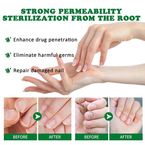 Natural Nail Treatment Gel, Nail Growth Serum for Repair & Strengthener (2)