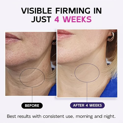 Skiennix Neck Firming Cream - Anti-Aging Moisturizer with Multi-Peptides & Retinol | 4.3 Fl Oz