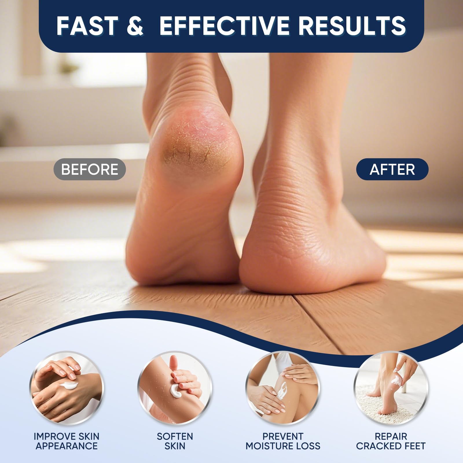VREKEF Urea Cream 40 Percent for Feet Maximum Strength, Urea Cream 40% Plus Salicylic Acid 2%, Foot & Hand Cream for Dry Cracked
