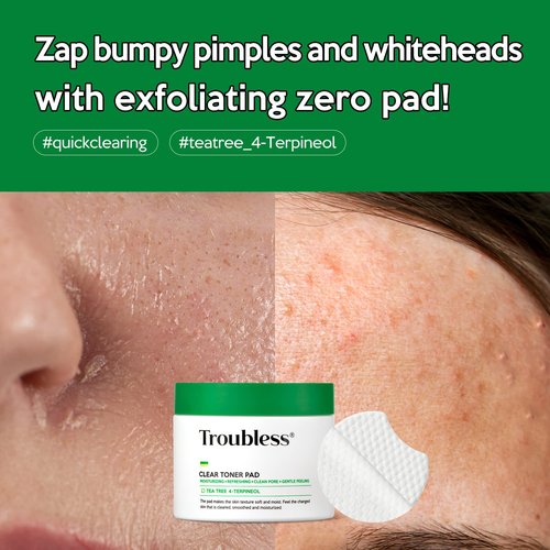 Troubless Clear Toner Pad for Face | Gentle Peeling & Facial Soothing Toner with Tea Tree, 60 Pads (5.57 oz)