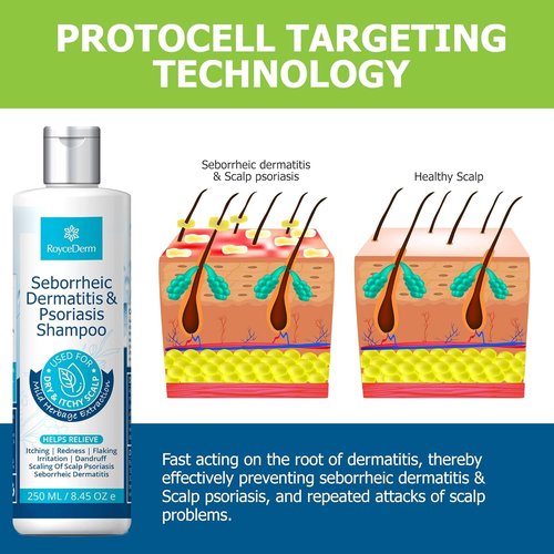 Roycederm Seborrheic Dermatitis Shampoo - Relieves Itching & Flaking for Dry Scalp Care