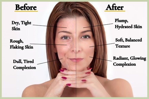 Goldcrest Naturals Moisturizing Face Mask For Dry Skin - Organic & Natural Skincare With Neem & Clay - Hydrates & Softens Skin - 100% Plant-Based, Cruelty-Free, Preservative-Free, & Eco-Friendly, 7 oz