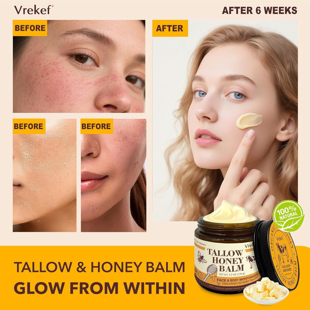 VREKEF Beef Tallow for Skin (4.2 oz)– Tallow and Honey Balm for Face & Body – Grass-Fed Tallow with Beeswax, Sea Buckthorn Oil, Shea Butter, Vitamin E – Natural Moisturizer
