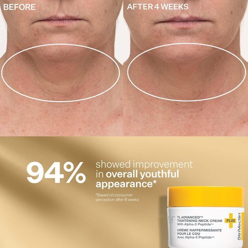 StriVectin Peptight Face Lift Serum - Tightening & Brightening Peptides for Youthful Skin