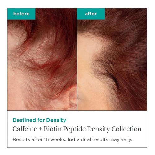 Briogeo Destined For Density Shampoo & Conditioner Duo - Boosts Thickness & Volume for Fine Hair | Sulfate-Free, Vegan