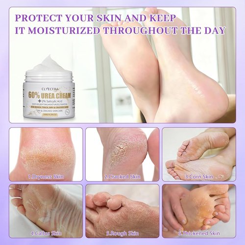 Urea Cream 60% by [Brand Name] - Maximum Strength 5-in-1 Moisturizer for Rough, Dry Skin | 150g