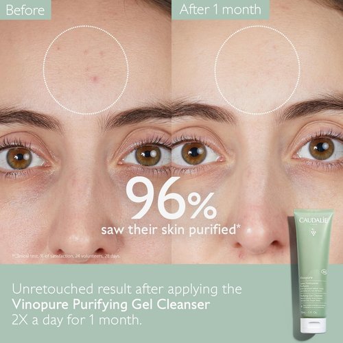Caudalie Vinopure Salicylic Acid Cleanser - Pore Purifying Gel for Clear Skin | 150 mL
