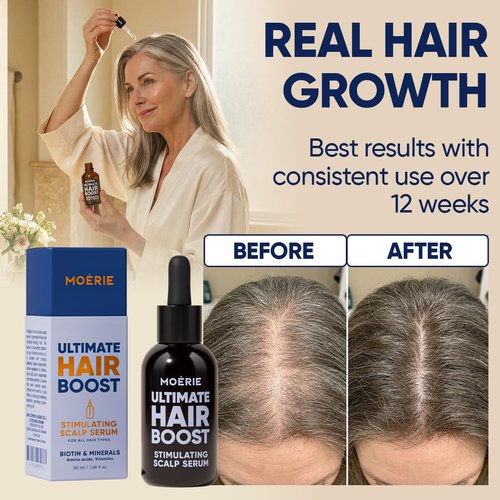 MOERIE Ultimate Hair Growth Serum - Natural Regrowth & Thickening Treatment for Women | 1.69 fl oz / 50 ml