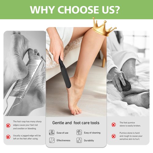 BALUCA Hard Skin Remover Nano Glass Foot File - Foot Callus Remover, Durable Foot Scrubber, Dead Skin Remover, Hygienic Pedicure Tool, Long Lasting Foot Buffer, Soft Smooth Feet, Black