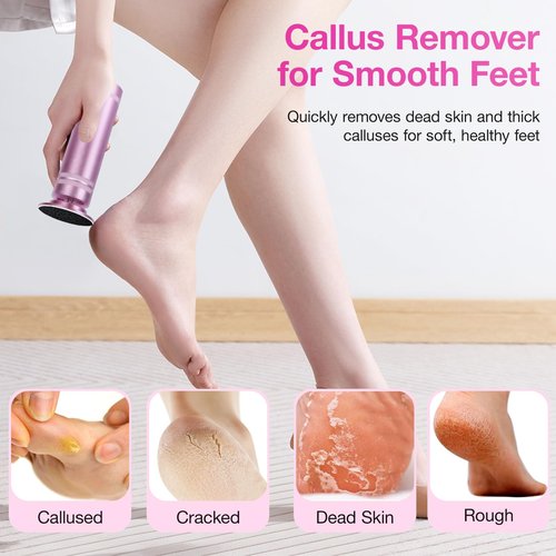 Hocent Upgrade 1200RPM Electric Callus Remover for Feet, Powerful Electric Foot File with 60 Sandpaper Discs, Adjustable Speed, Plug-in Pedicure Tool for Cracked Heels & Dead Skin, Pink