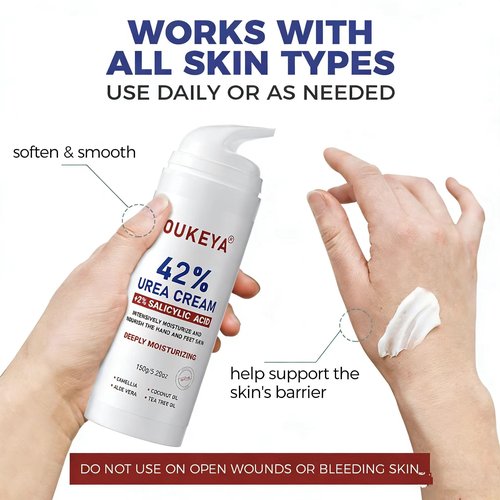 OUKEYA Urea Cream with Salicylic Acid for Dry, Rough Skin – Moisturiser for Feet, Heels, Hands & Elbows, 5.29 Oz