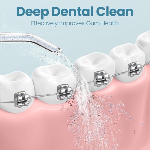 Onlyone Water Dental Flosser Replacement Heads Oral Irrigator Refill Heads Jet Tips 5 Pieces: Only Compatible for Onlyone Water Dental Flosser