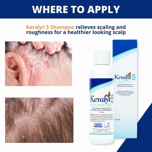 5 Anti-Dandruff Shampoo - Max Strength 5% Salicylic Acid for Scalp Relief | 177ml