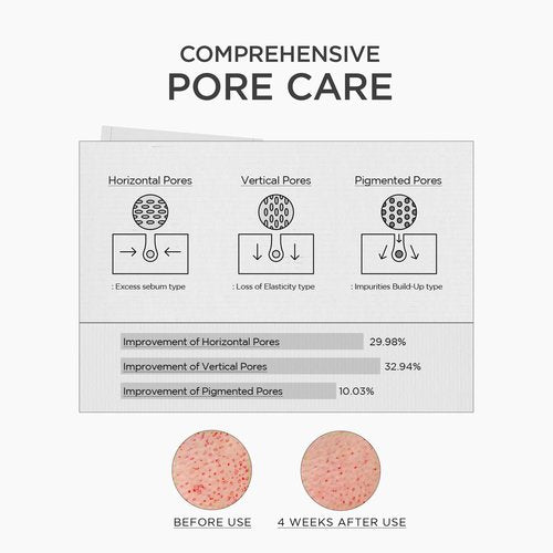 SKIN1004 Niacinamide 10% Boosting Shot Ampoule, Valentine Gifts, Hydrating Niacinamide Spicule Serum, Korean Facial Ampoule with Tranexamic Acid, Madagascar Centella, Korean Skin Care, 1.01fl.oz/ 30ml