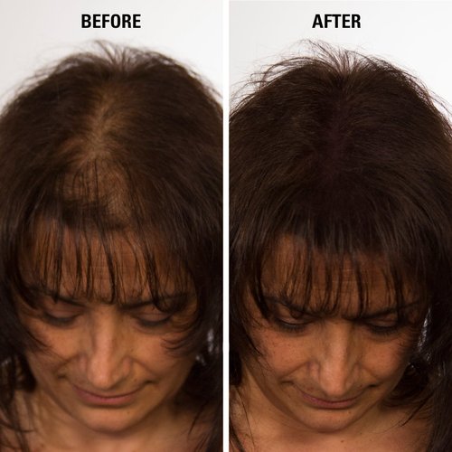 INFINITY Hair Fibers Black for Thinning Hair for Women & Men - 100% Undetectable Hair Building Fiber Powder - Conceal Hair Loss in 15 Seconds, 30g