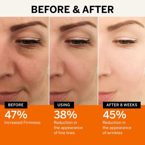 Lupure Vitamin C Face Serum: Anti Aging Facial Super Vit C Serum with Ferulic Acid Pure L-Ascorbic Acid, Vitamin E and Hyaluronic Acid for Dark Spots and Skin Care