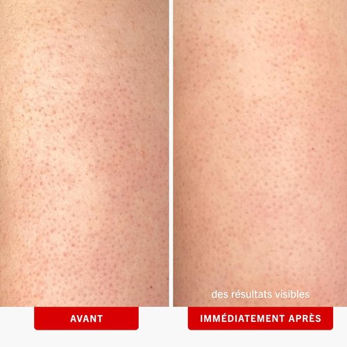 First Aid Beauty KP Bump Eraser Body Scrub - 10% AHA Exfoliator for Keratosis Pilaris | 8 oz