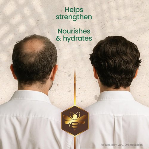 Tio Nacho Mexican Herbs Shampoo - Strengthening Formula with Royal Jelly & Ginseng | 32 Fl Oz