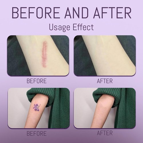 Skiennix Body Coverage Perfector - Waterproof Makeup with Brush & Puff - Full Coverage for Tattoos & Scars (2.0oz Natural Beige)