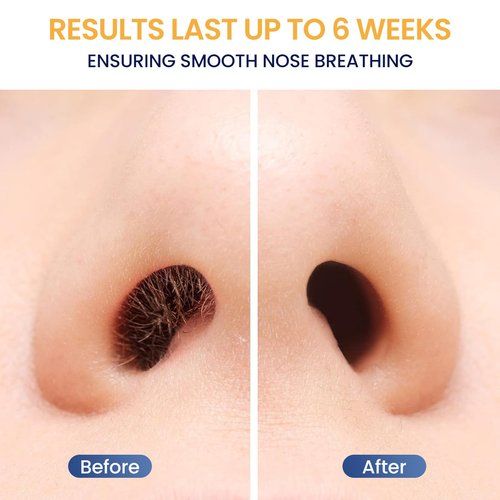 Nose Hair Wax Kit for Men, Nose Wax Removal with 100 g Wax, 40 Applicators, 15-20 Times, Ear Nasal Hair Waxing For Men and Women, Usb Rapid Heating, Constant Temperature, Painless, Black