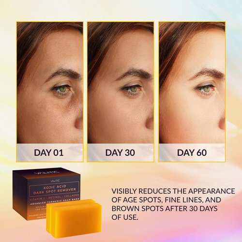 VALITIC Kojic Acid Dark Spot Remover Soap Bars - Vitamin C & Retinol Infused, 2 Pack