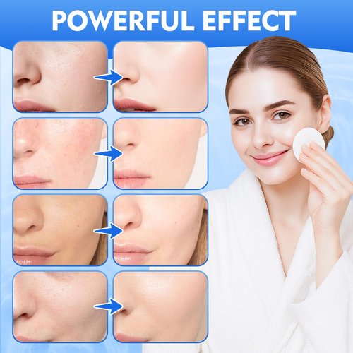 Glycolic Acid Pads, Dual-Sided Facial Exfoliating Pads with Glycolic Acid & Niacinamide to Reduce Wrinkles, Deep Clean Pores and Brighten Skin, for All Skin Types, 60 Count