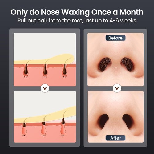 CAVSTORM Nose Wax Kit Men, Nose Hair Waxing Kit with 158°F Smart Temp Control, 40 Sticks, 100g Wax, Painless Nose Hair Removal with USB-C Fast Heating, Upgraded Capacity, Multi-Accessories