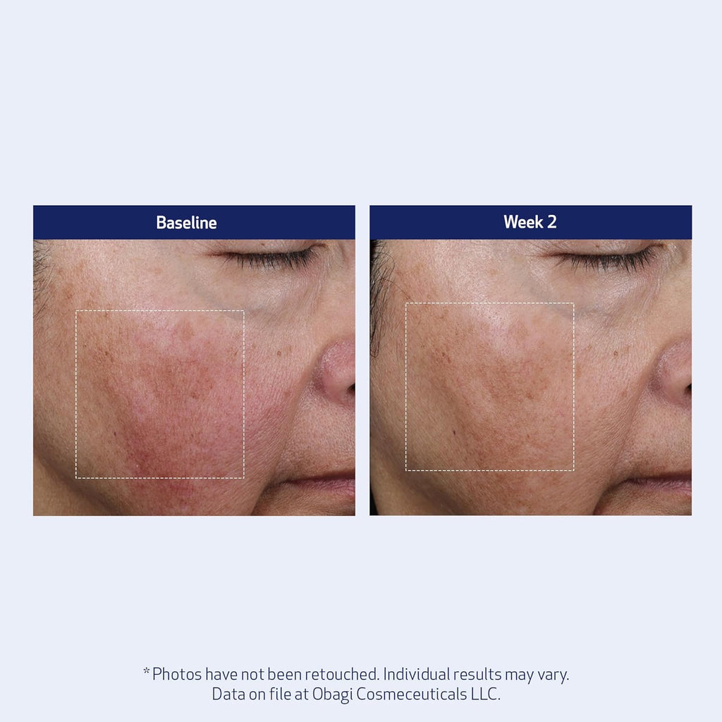 SUZANOBAGIMD Super Antioxidant Serum - Reduces Fine Lines & Wrinkles, Brightens Skin Tone - 1 oz