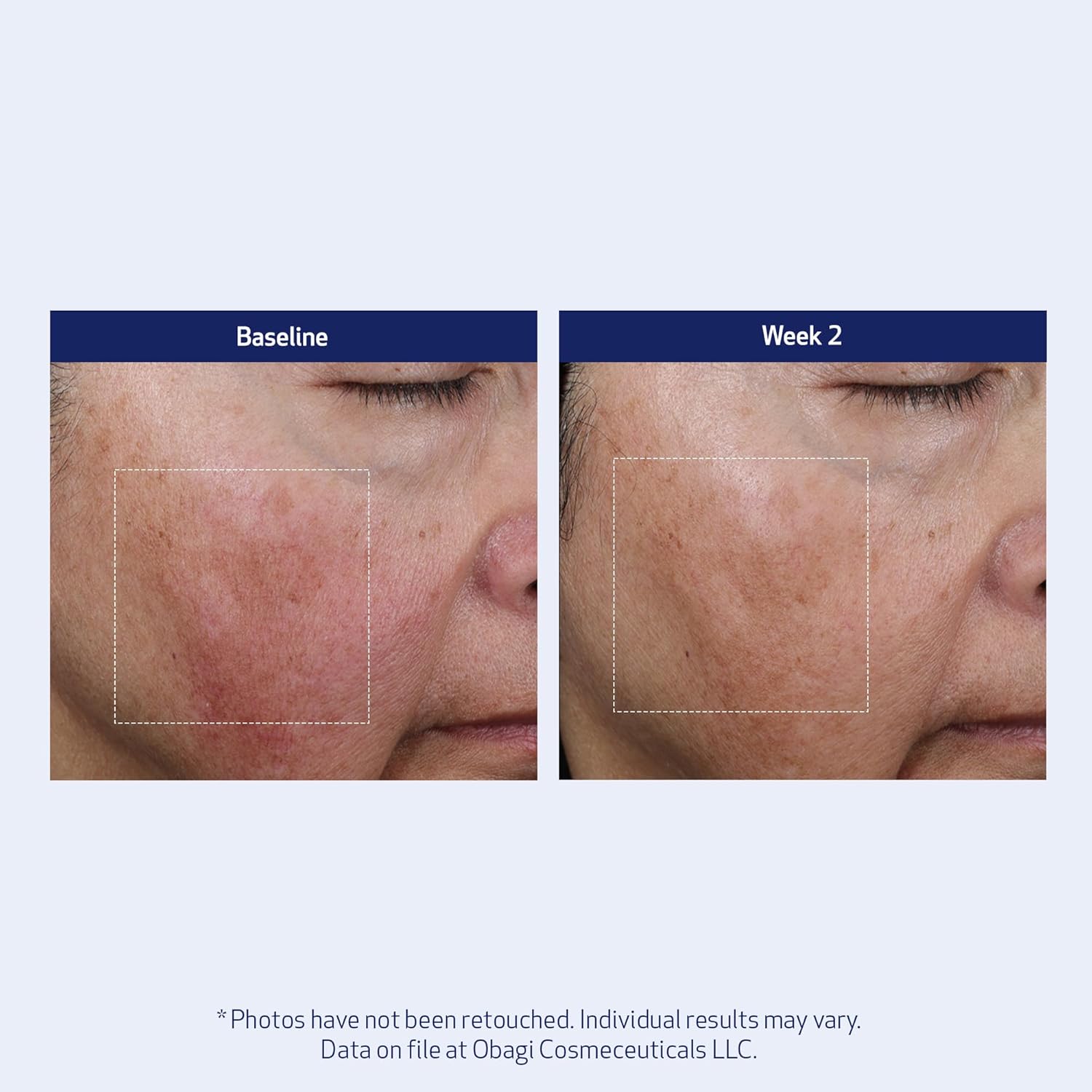 SUZANOBAGIMD Super Antioxidant Serum - Reduces Fine Lines & Wrinkles, Brightens Skin Tone - 1 oz