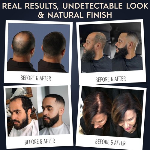 Hair Illusion | Black Real Fibers & Holding Spray for Thinning Hair - Natural Texture, 18g