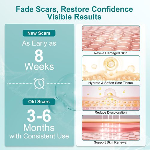 Scar Cream Silicone Scar Gel, Powerful Scar Removal Cream for Old & New Scars, Helps Reduce Surgical Scars, Acne, Burn, Keloids & Stretch Marks, 1.76 oz (50g)