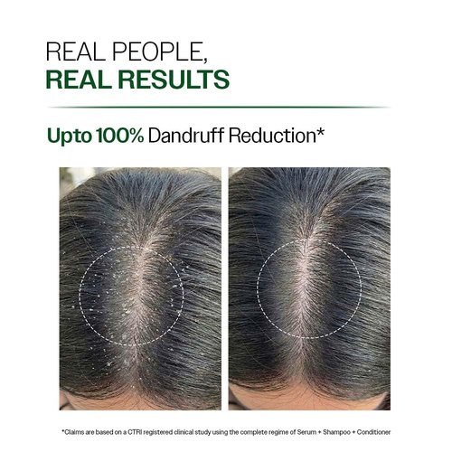 Bare Anatomy Anti-Dandruff Shampoo - Reduces Dandruff & Strengthens Hair | Derma Approved with Salicylic Acid & Biotin | 100ml