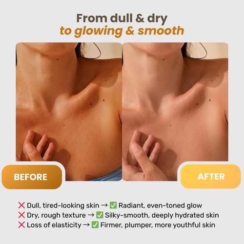 Clarimond Vitamin C Body Lotion w/Hyaluronic Acid & Collagen Peptides - Brightening Hydrating Moisturizer Non-Greasy for Dry, Sensitive Skin - Firming Tightening Body Cream
