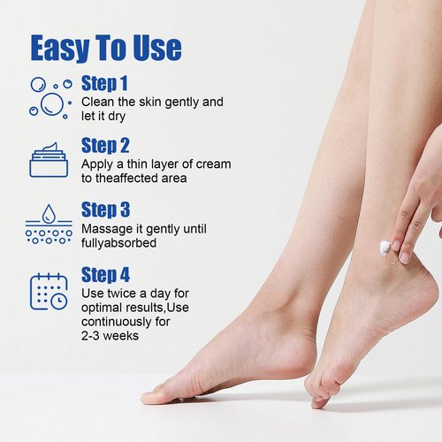 Urea Cream 60% plus 2% Salicylic Acid for Feet Maximum Strength - Lotion For Dry Cracked Feet Elbows Knees Heels Hands, Hydrates Foot Care for Softening and Moisturizing, Callus Remover 10.1oz