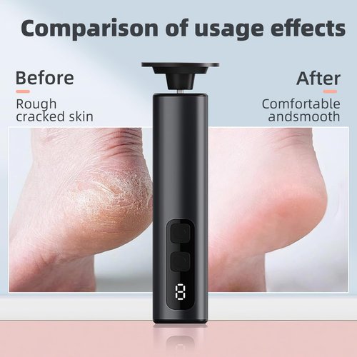 Electric Callus Remover for Feet, 9 Speed Rechargeable Pedicure Tools for Feet, Callous Remover Tool for Remove Cracked Heels and Feet Scrubber Dead Skin, Replaceable Sandpaper Discs, Battery Display