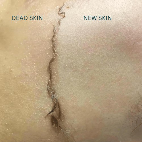 Dermaplaning Oil for Dry Skin - Hydrating Face Shaving Oil for Women - Safe for Acne Prone Skin - Non Comedogenic, Fragrance Free, Natural and Hypoallergenic for Pre & Post Dermaplaning 4oz by Ouiloe