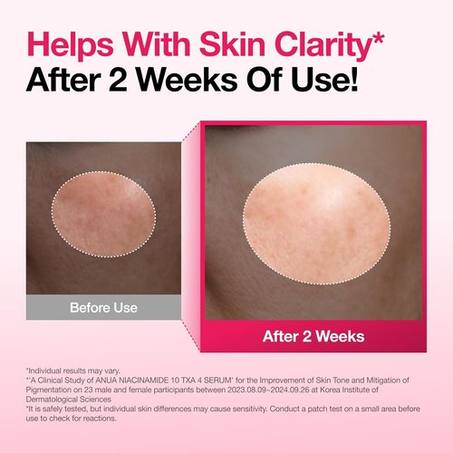 Anua Niacinamide 10 + TXA 4 Serum - Dark Spot Care & Hydration | Lightweight Korean Skincare, 1.01 fl. oz.