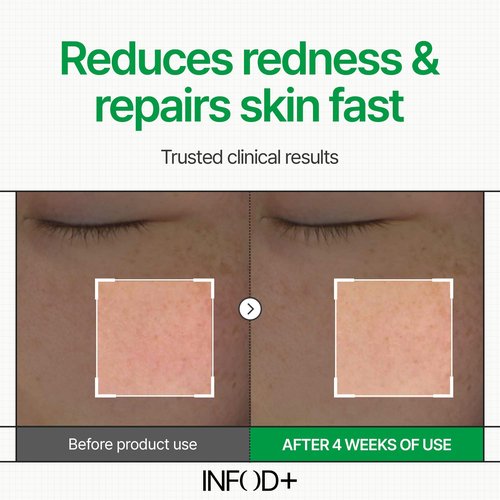 INFODPLUS Korean Skin Care Sensitive Face Cream, Lightweight Moisturizer with Ceramides & Panthenol, Skin Barrier Support & Deep Hydration, Low pH Daily Cream for AM/PM Use, 50ml