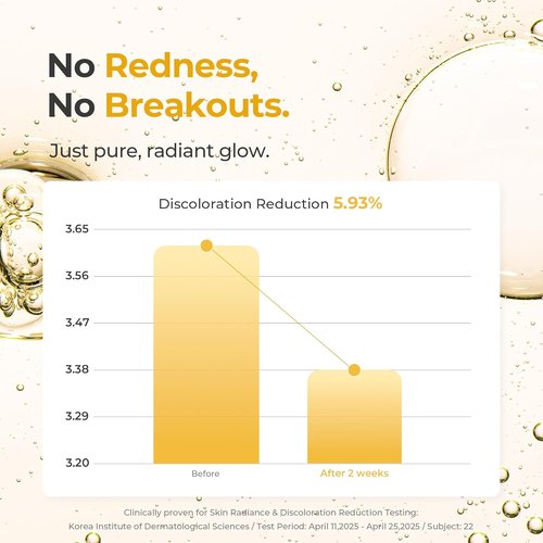 Glutathione All-In-One Brightening Serum - Niacinamide, Kojic Acid & Turmeric for Radiant, Even-Tone Skin