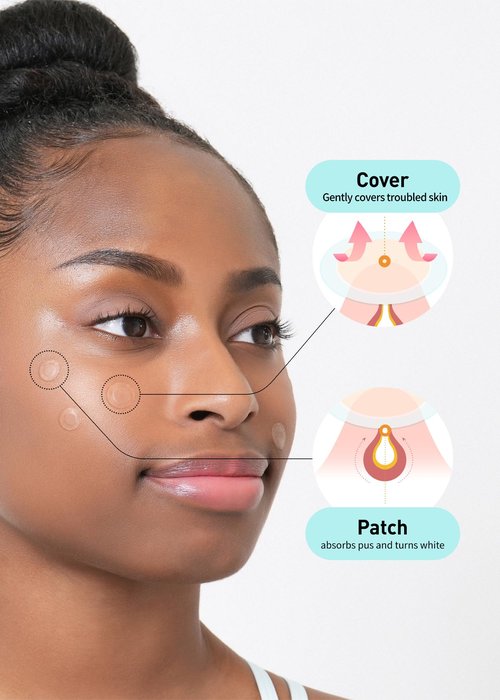 OLIVE YOUNG Care Plus Spot Patch Big (81 Count) | Hydrocolloid Patch, Spot Stickers for Acne Pimple and Zits