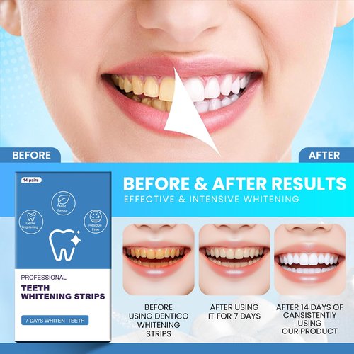 Teeth whitening Strip,28 Sensitivity Free Whitening Strips, Peroxide Free,14 Treatments Kit Professional and Safe Teeth whitening Strips
